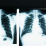 De regering stelt in haar wet ter voorkoming van beroepsrisico's voor dat werknemers bij indiensttreding een medisch onderzoek ondergaan.